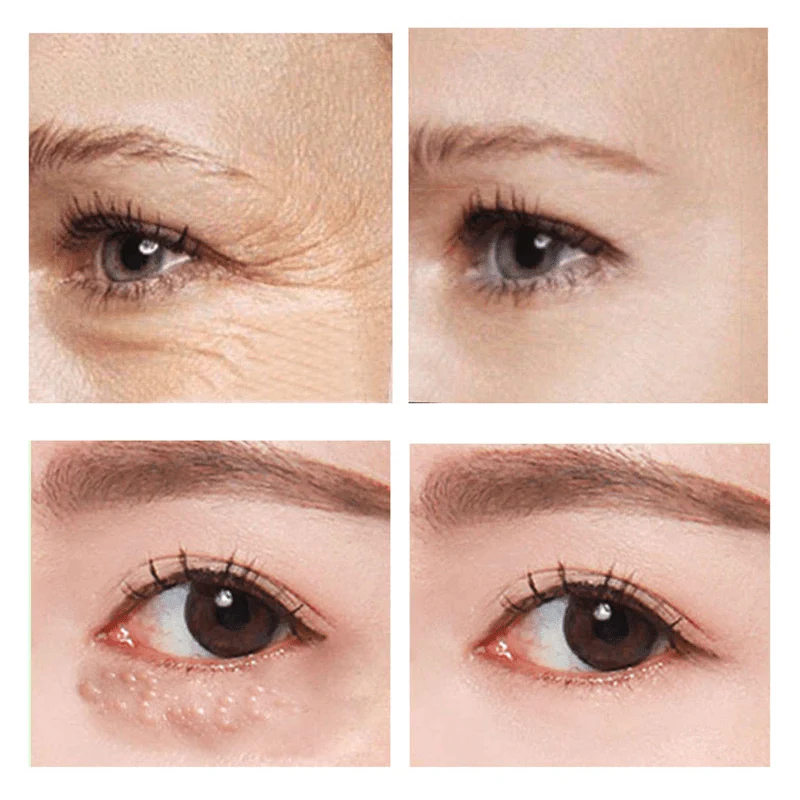 SleekEyes™ Temporäre Straffende Augencreme - Image 4